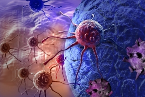 6 objaww raka, ktre ludzie zwykle ignoruj [Fot. vitanovski - Fotolia.com]