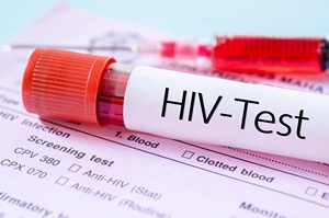 AIDS po 35 latach od odkrycia. Leczenie HIV - wiateko w tunelu?  [© gamjai - Fotolia.com]