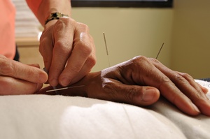 Akupunktura pomocna w leczeniu depresji? [© John Keith - Fotolia.com]