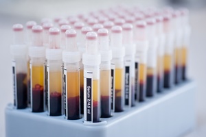 Badania krwi pozwol przewidzie starzenie si organizmu [© ibajars - Fotolia.com]