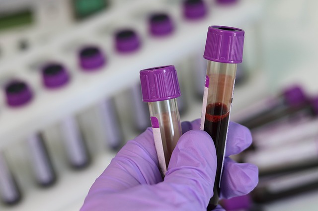 Badanie krwi pozwoli zdiagnozowa zaburzenia lkowe [fot. Belova59 from Pixabay]