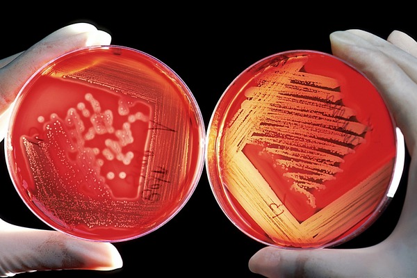 Bakterie te maj wpyw na ryzyko zawau [fot. WikiImages z Pixabay]