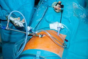 Chirurgia maoinwazyjna: mae blizny i krtki pobyt w szpitalu [© Firma V - Fotolia.com]