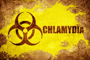 Chlamydioza: najczstsza choroba weneryczna [Fot. Argus - Fotolia.com]