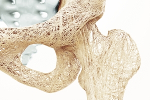 Co trzecia kobieta na wiecie cierpi na osteoporoz. Jak y z t chorob? [Fot. crevis - Fotolia.com]