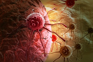 Coraz wicej przypadkw raka na wiecie - nowe statystyki [© vitanovski - Fotolia.com]