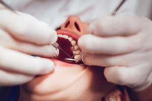 Cukrzyc wykryjesz u... dentysty. Stomatolodzy coraz czciej pomagaj j diagnozowa [Fot. brankamarkovic78 - Fotolia.com]