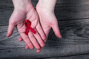 Czym jest AIDS i jak si przed nim ochroni? 28. wiatowy dzie AIDS [AIDS, © lordn - Fotolia.com]