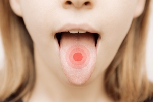 Gorzki posmak w ustach. Co moe oznacza? [Fot. ALDECAstudio - Fotolia.com]