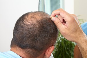 Jak przeciwdziałać wypadaniu włosów? [© Petrik - Fotolia.com]