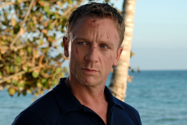 James Bond u chirurga [Daniel Craig fot. UIP]