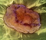Jednemu na sze nowotworw mona zapobiec [© Mopic - Fotolia.com]