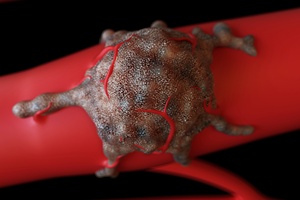 Kiedy rozwijaj si dwa niezalene nowotwory  [©  Sebastian Kaulitzki - Fotolia.com]