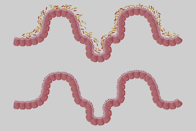 Mikrobiom jelitowy wpywa na skuteczno odchudzania [fot. LJNovaScotia from Pixabay]