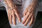 Najstarsza kobieta na wiecie koczy 116 lat [© ftelkov - Fotolia.com]