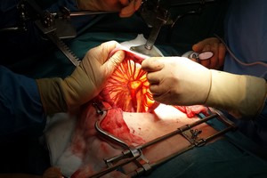 Odkryto nowy organ w ludzkim ciele [©  kerale - Fotolia.com]