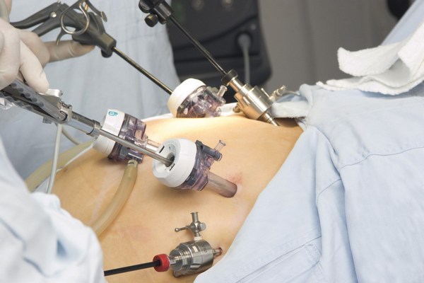 Operacja bariatryczna - z jakimi zaburzeniami trzeba si liczy [© reflektastudios - Fotolia.com]