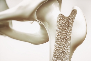 Osteoporoza. Zagroone gwnie kobiety [Fot. crevis - Fotolia.com]
