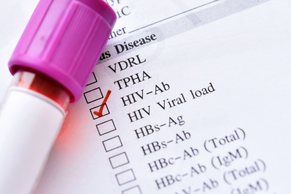 Rekordowa liczba zakaonych wirusem HIV [Fot. jarun011 - Fotolia.com]