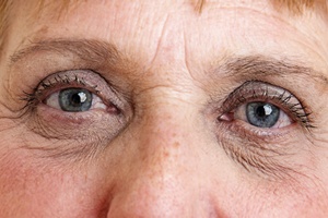 Siedem krokw do zachowania zdrowia oczu [© Vera Kuttelvaserova - Fotolia.com]
