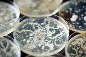 Sia ukadu odpornociowego zaley od... statusu spoecznego [Bakterie, © Leigh Prather - Fotolia.com]
