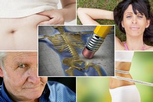 Tego o osteoporozie moge nie wiedzie. 4 ciekawe fakty [fot. collage Senior.pl]