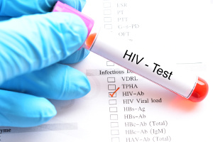 Udzia pacjentw w procesie leczenia infekcji HIV [Fot. jarun011 - Fotolia.com]