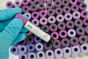 Wirusa HCV mona pokona [© jarun011 - Fotolia.com]
