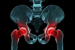Wymiana stawu biodrowego lub kolanowego a ryzyko zawau [© Sebastian Kaulitzki - Fotolia.com]