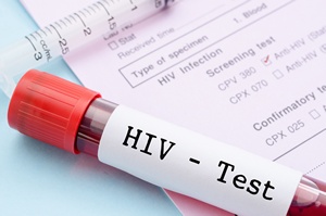 Zrb test na HIV [© gamjai - Fotolia.com]